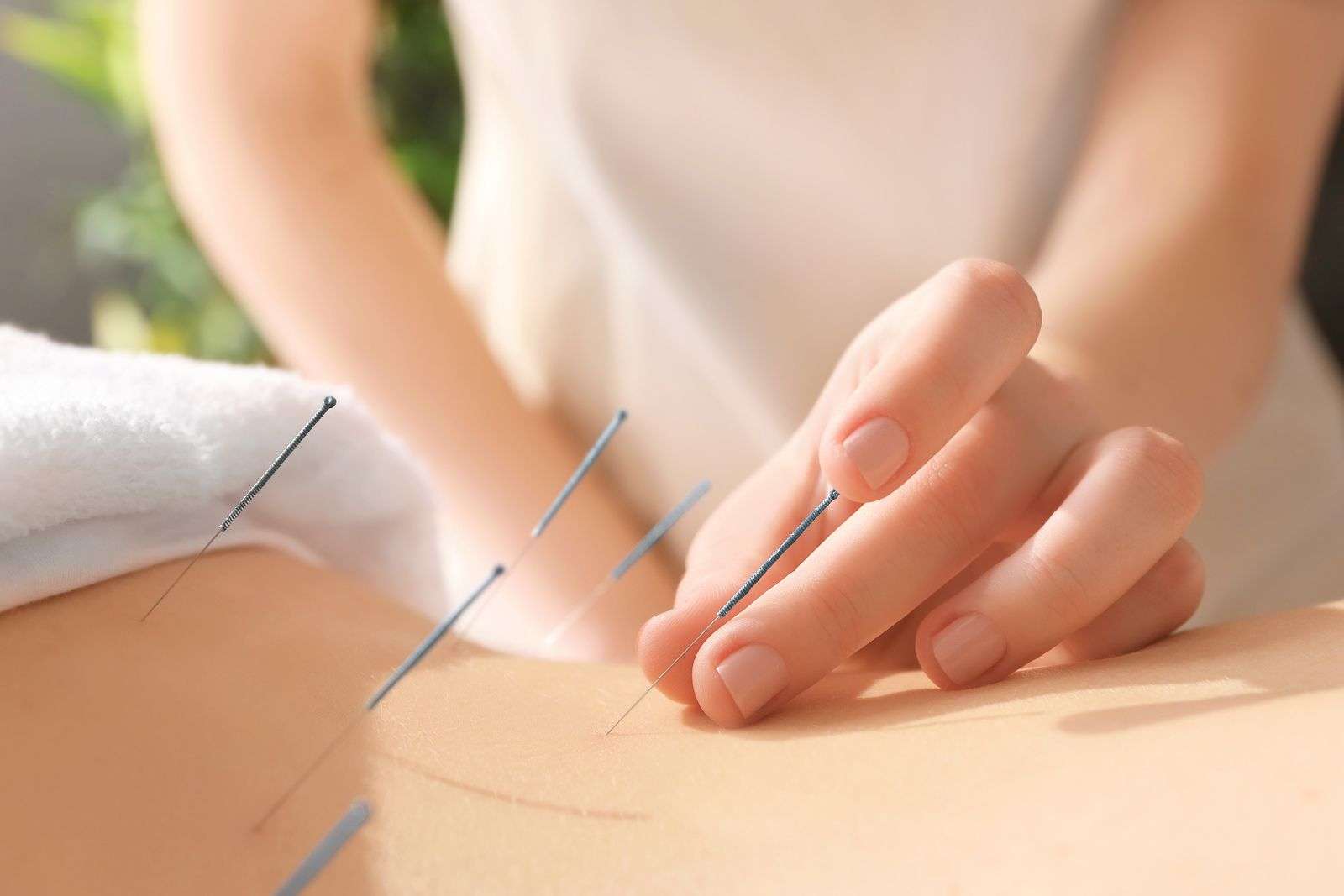 https://centroholisticowicca.com/wp-content/uploads/2020/09/todos-los-detalles-sobre-la-primera-sesion-de-acupuntura.jpeg